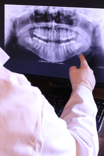Best Urgent Care for Lost Fillings or Crowns in New Concord, OH
