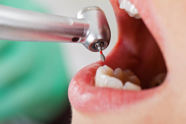Best Emergency Gum Treatment in New Concord, OH